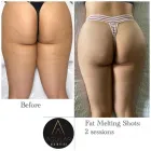 Business 4 image AGUILAR AESTHETICS - MED SPA Wellness Center in Oakland Park FL