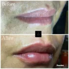 Business 5 image AGUILAR AESTHETICS - MED SPA Wellness Center in Oakland Park FL