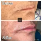 Business 6 image AGUILAR AESTHETICS - MED SPA Wellness Center in Oakland Park FL