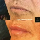 Business 8 image AGUILAR AESTHETICS - MED SPA Wellness Center in Oakland Park FL