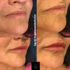 Business 10 image AGUILAR AESTHETICS - MED SPA Wellness Center in Oakland Park FL