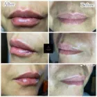 Business 11 image AGUILAR AESTHETICS - MED SPA Wellness Center in Oakland Park FL
