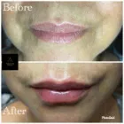 Business 12 image AGUILAR AESTHETICS - MED SPA Wellness Center in Oakland Park FL
