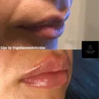 Business 14 image AGUILAR AESTHETICS - MED SPA Wellness Center in Oakland Park FL