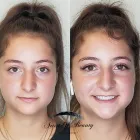 Business 11 image ARTIST OF BEAUTY Tattoo Removal in Los Angeles CA