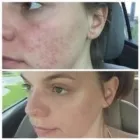Business 2 image BEAUTIFUL SKIN BY CARMEN in Orlando FL