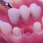 Business 3 image BLUE MOUNTAIN DENTISTRY Teeth Whitening Service in San Diego CA