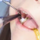 Business 5 image BLUE MOUNTAIN DENTISTRY Teeth Whitening Service in San Diego CA