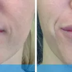 Business 1 image DERMACARE LASER & SKIN CARE CLINICS Tattoo Removal in San Diego CA