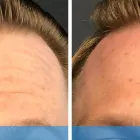 Business 2 image DERMACARE LASER & SKIN CARE CLINICS Tattoo Removal in San Diego CA