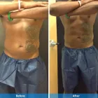 Business 3 image DERMACARE LASER & SKIN CARE CLINICS Tattoo Removal in San Diego CA