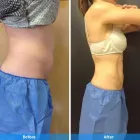 Business 4 image DERMACARE LASER & SKIN CARE CLINICS Tattoo Removal in San Diego CA