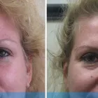 Business 5 image DERMACARE LASER & SKIN CARE CLINICS Tattoo Removal in San Diego CA