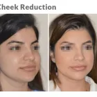 Business 1 image DR. ANTHONY BARED, M.D - FACIAL PLASTIC SURGEON Plastic Surgeons in Maimi FL