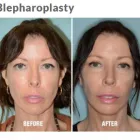 Business 2 image DR. ANTHONY BARED, M.D - FACIAL PLASTIC SURGEON Plastic Surgeons in Maimi FL