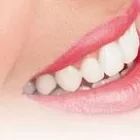 Business 8 image DRS. DECKER AND MCCLANAHAN APC Tooth Bonding in San Diego CA