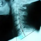 Business 5 image ED CAMP CHIROPRACTIC Physicians & Surgeons, Sports Medicine in San Francisco CA