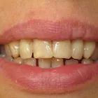 Business 3 image EMERGENCY DENTAL SERVICE ORLANDO, FL 32806 Implant Dentistry in Orlando FL