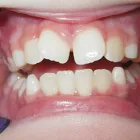 Business 5 image EMERGENCY DENTAL SERVICE SAN DIEGO, CA 92128 Pediatric Dentistry in San Diego CA