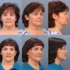 Business 1 image ERNESTO J RUAS MD FACS Tummy Tuck in Tampa FL