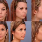 Business 6 image ERNESTO J RUAS MD FACS Tummy Tuck in Tampa FL