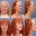 Business 7 image ERNESTO J RUAS MD FACS Tummy Tuck in Tampa FL