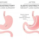 Business 1 image GASTRIC BYPASS SURGERY Weight Loss in Miami Gardens FL