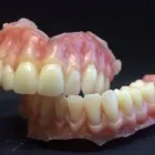 Business 7 image IMPLANTS WITHOUT SCREWS Implant Dentistry in Tampaa FL