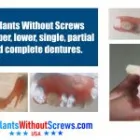 Business 8 image IMPLANTS WITHOUT SCREWS Implant Dentistry in Tampaa FL