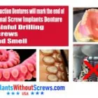 Business 1 image IMPLANTS WITHOUT SCREWS Implant Dentistry in Tampaa FL