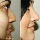 Business 2 image JAIBAJI PLASTIC SURGERY in San Diego CA