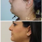 Business 12 image JAIBAJI PLASTIC SURGERY in San Diego CA