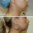 Business 15 image JAIBAJI PLASTIC SURGERY in San Diego CA