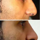 Business 19 image JAIBAJI PLASTIC SURGERY in San Diego CA