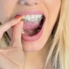 Business 1 image LA MESA DENTAL SERVICES General Dentist in San Diego CA