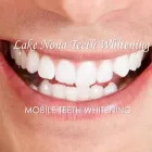 Business 1 image LAKE NONA TEETH WHITENING in Orlando FL