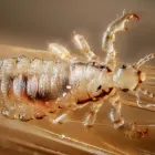 Business 1 image LICE REMOVAL LOS ANGELES CARE Home Health Care in Los Angeles CA