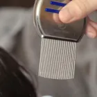 Business 3 image LICE REMOVAL LOS ANGELES CARE Home Health Care in Los Angeles CA