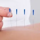 Business 2 image MEIS ACUPUNCTURE Acupuncture in Orlando FL