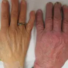 Business 1 image MEIS ACUPUNCTURE Acupuncture in Orlando FL