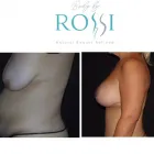 Business 5 image MICHAEL T. ROSSI, MD in San Diego CA