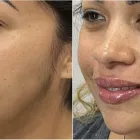 Business 2 image MODERN VITALITY MEDICINE Skin Care in Orlando FL