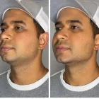 Business 4 image MODERN VITALITY MEDICINE Skin Care in Orlando FL