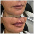 Business 6 image MODERN VITALITY MEDICINE Skin Care in Orlando FL