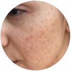 Business 3 image PERFECT SKIN Beauty Products in Orlando FL