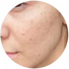 Business 4 image PERFECT SKIN Beauty Products in Orlando FL