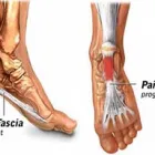 Business 4 image PLANTAR FASCIITIS SURGERY CENTER Health & Medicine in New York NY