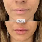 Business 3 image PRETTY PLEASE AESTHETICS Medical Spas in Sacramento CA