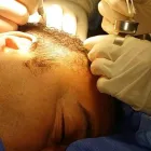 Business 1 image TEMPUS HAIR RESTORATION Hair Replacement in Lake Mary FL