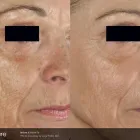 Business 2 image THE SKIN CENTER AT SOUTHGATE MEDICAL GROUP in West Seneca NY